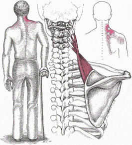 Neck Pain - Whole Body Health